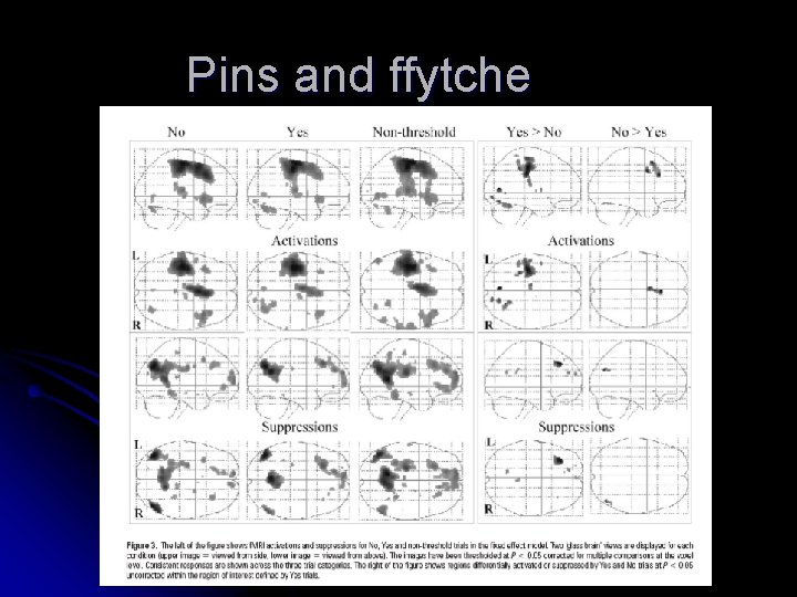 Pins and ffytche 
