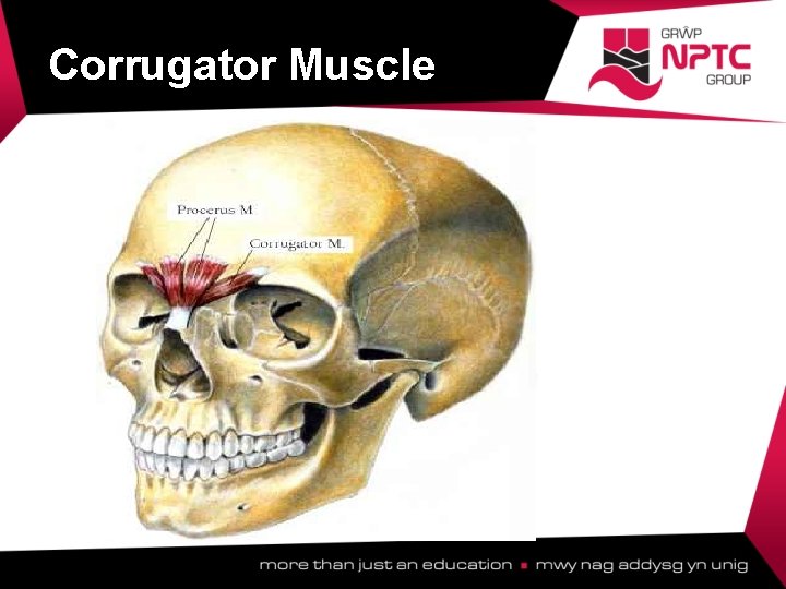 Corrugator Muscle  Corrugator Muscle