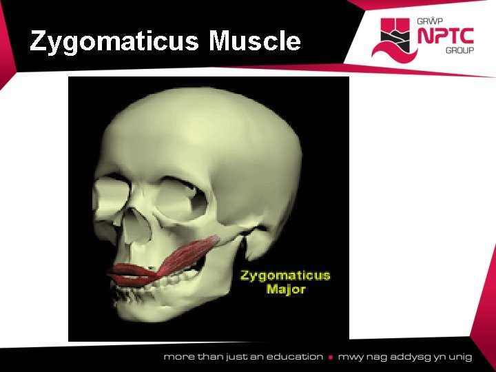 Zygomaticus Muscle  Zygomaticus Muscle