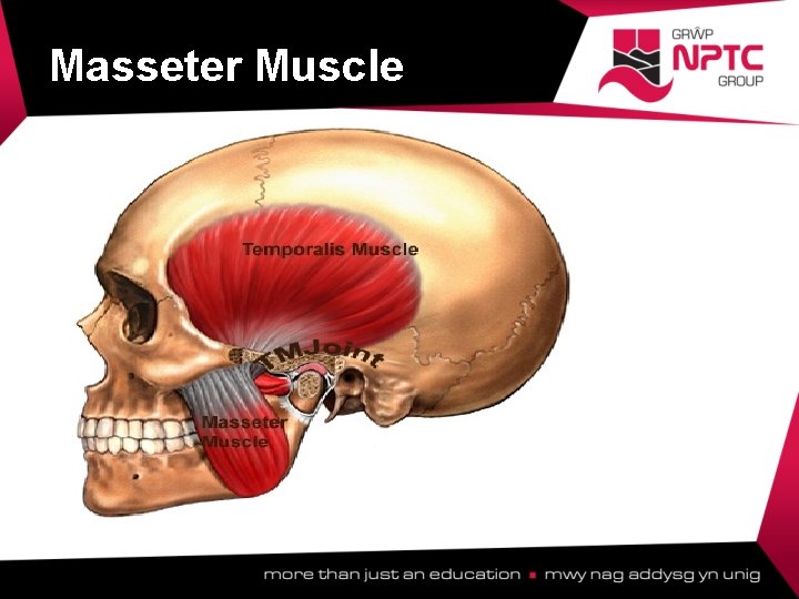Masseter Muscle  Masseter Muscle