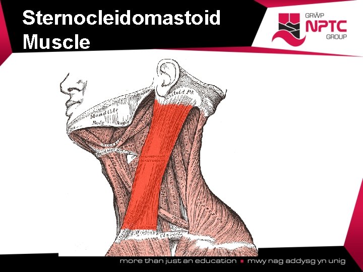 Sternocleidomastoid Muscle  Sternocleidomastoid Muscle