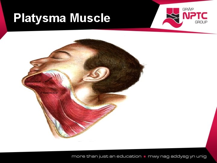 Platysma Muscle  Platysma Muscle