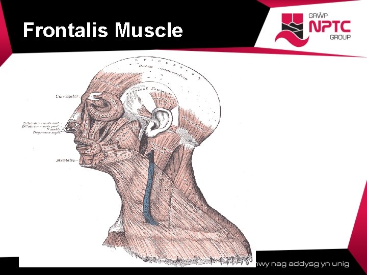Frontalis Muscle  Frontalis Muscle