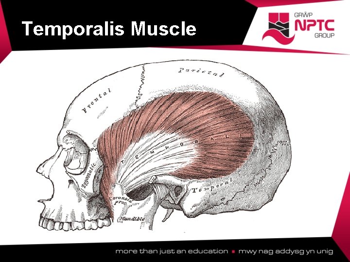 Temporalis Muscle  Temporalis Muscle