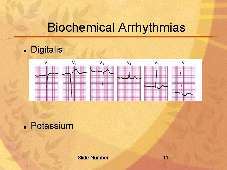 Biochemical Arrhythmias Digitalis Potassium Slide Number 11 