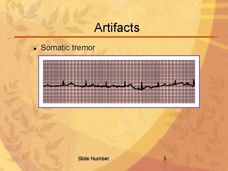 Artifacts Somatic tremor Slide Number 3 