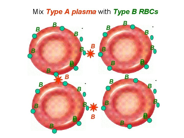 Mix Type A plasma with Type B RBCs B B B B B B