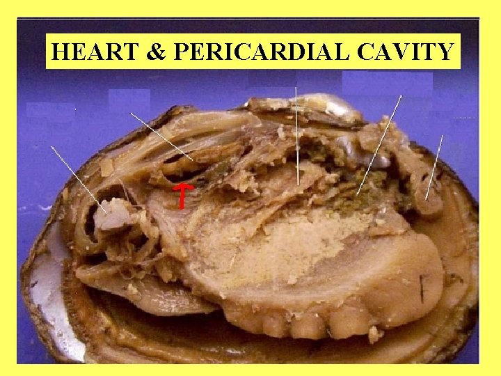 HEART & PERICARDIAL CAVITY 