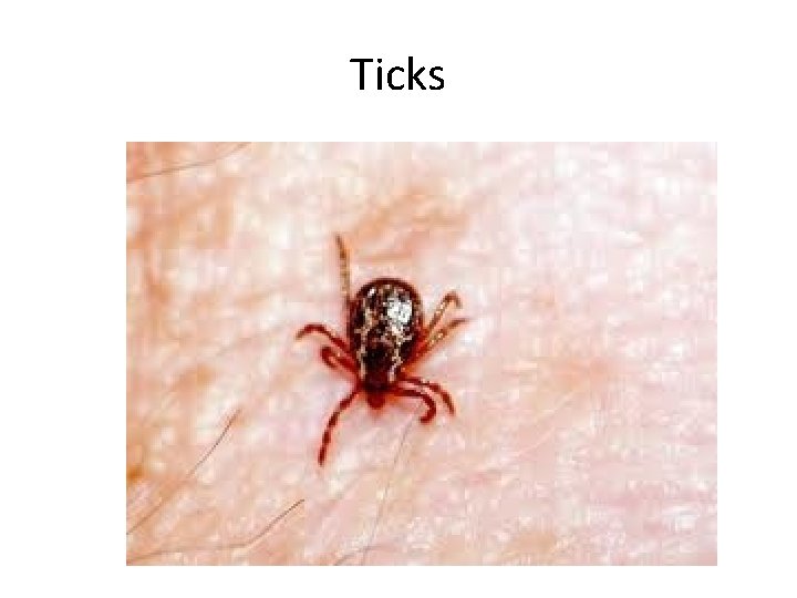 Ticks 