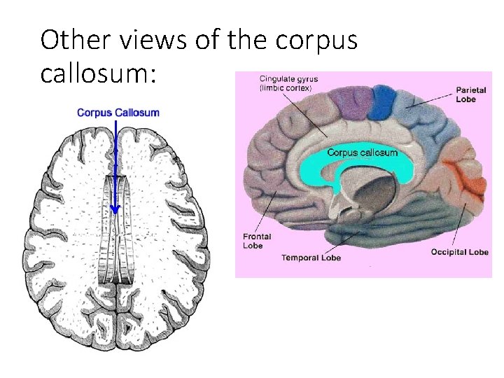 Other views of the corpus callosum: 