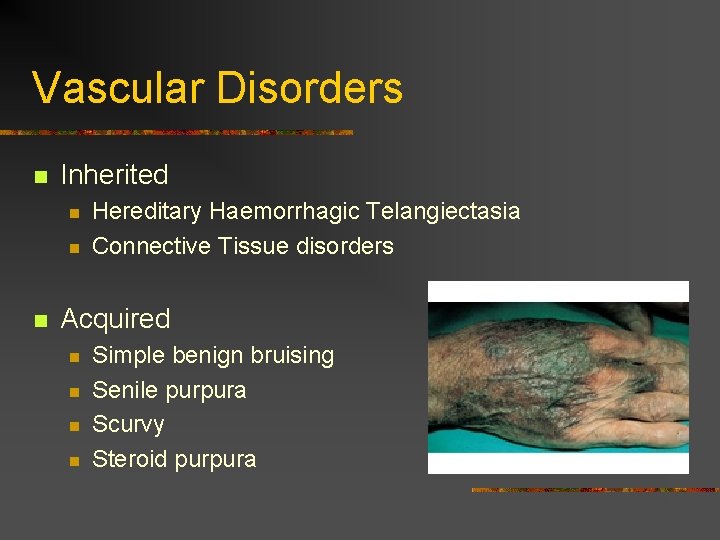 Vascular Disorders n Inherited n n n Hereditary Haemorrhagic Telangiectasia Connective Tissue disorders Acquired