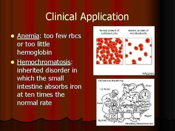 Clinical Application Anemia: too few rbcs or too little hemoglobin l Hemochromatosis: inherited disorder