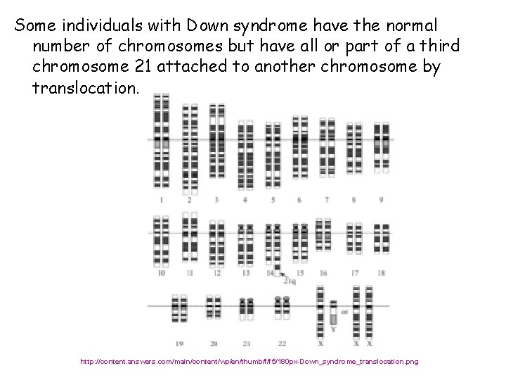 Some individuals with Down syndrome have the normal number of chromosomes but have all