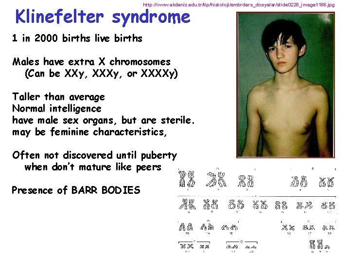 http: //www. akdeniz. edu. tr/tip/histoloji/embrders_dosyalar/slide 0228_image 1186. jpg Klinefelter syndrome 1 in 2000 births