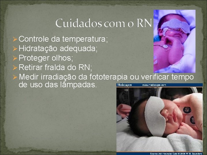 Ø Controle da temperatura; Ø Hidratação adequada; Ø Proteger olhos; Ø Retirar fralda do