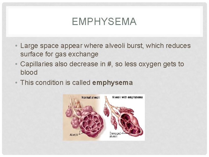 EMPHYSEMA • Large space appear where alveoli burst, which reduces surface for gas exchange