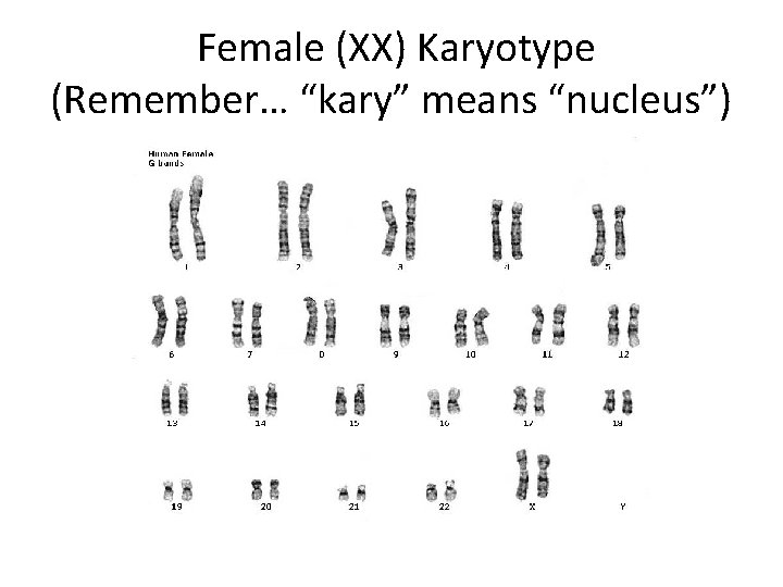 Female (XX) Karyotype (Remember… “kary” means “nucleus”) 