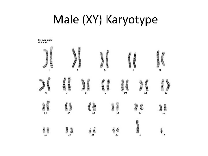 Male (XY) Karyotype 