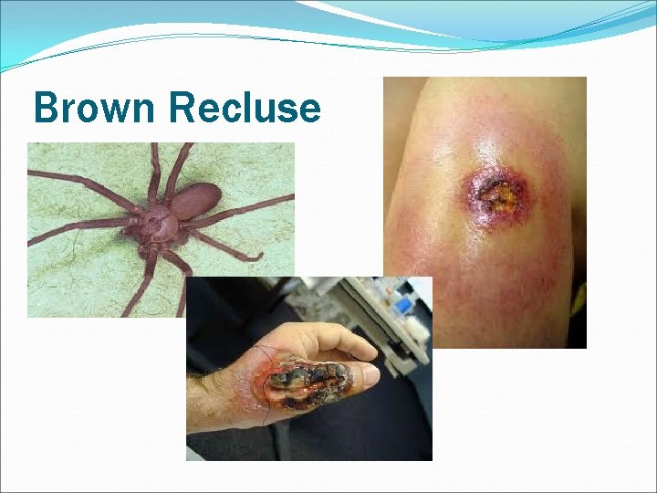 Brown Recluse 