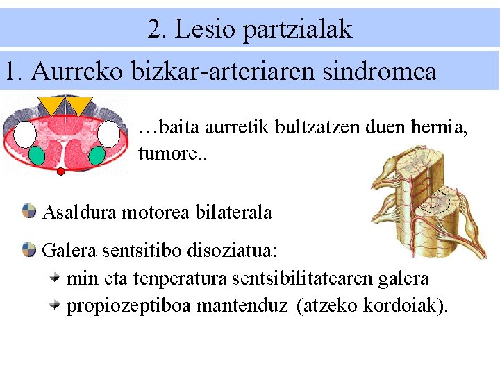 2. Lesio partzialak 1. Aurreko bizkar-arteriaren sindromea …baita aurretik bultzatzen duen hernia, tumore. .