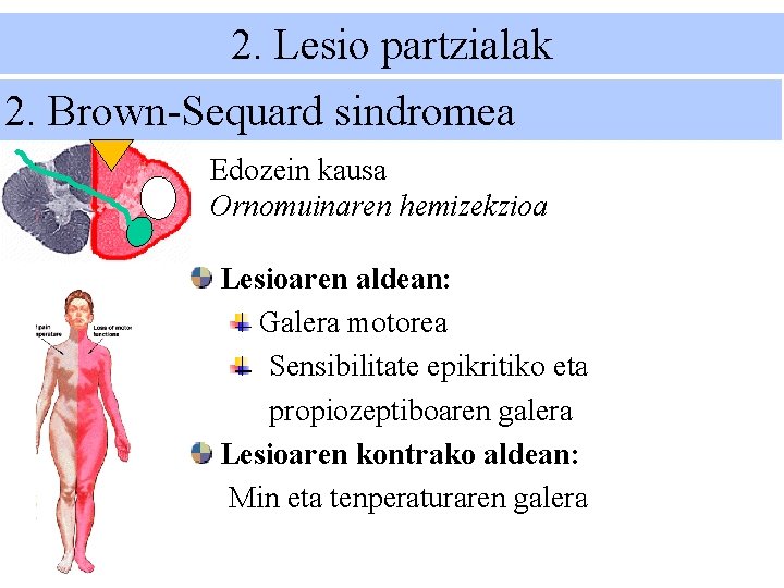 2. Lesio partzialak 2. Brown-Sequard sindromea Edozein kausa Ornomuinaren hemizekzioa Lesioaren aldean: Galera motorea