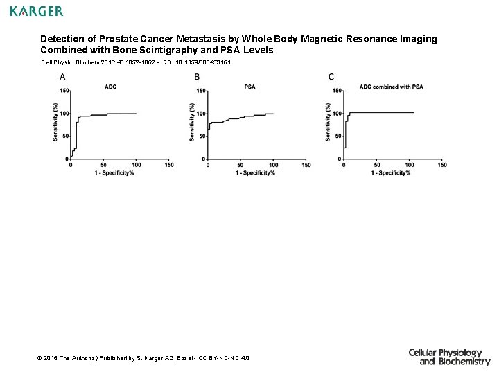 Detection of Prostate Cancer Metastasis by Whole Body