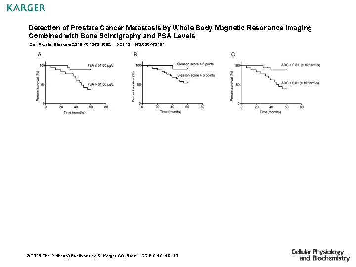 Detection of Prostate Cancer Metastasis by Whole Body