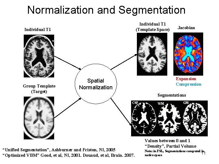 Normalization and Segmentation Individual T 1 (Template Space) Individual T 1 Group Template (Target)