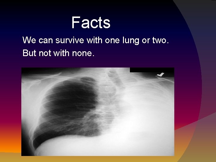 Facts We can survive with one lung or two. But not with none. 