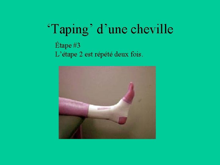 ‘Taping’ d’une cheville Étape #3 L’étape 2 est répété deux fois. 