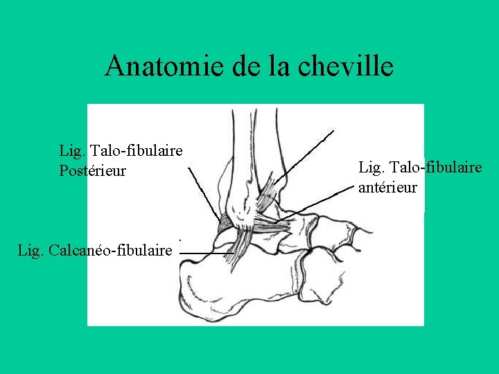 Anatomie de la cheville Lig. Talo-fibulaire Postérieur Lig. Calcanéo-fibulaire Lig. Talo-fibulaire antérieur 