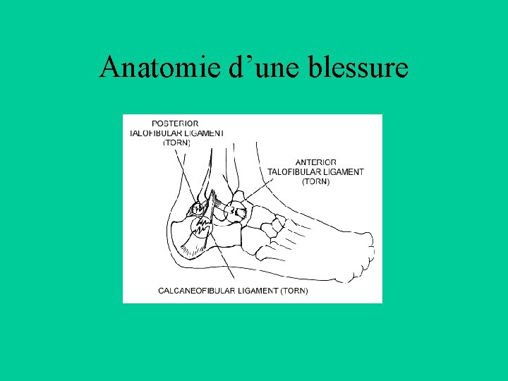 Anatomie d’une blessure 