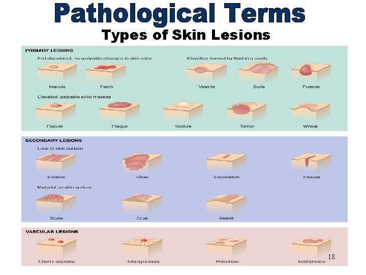 Types of Skin Lesions Primary Lesions 18 