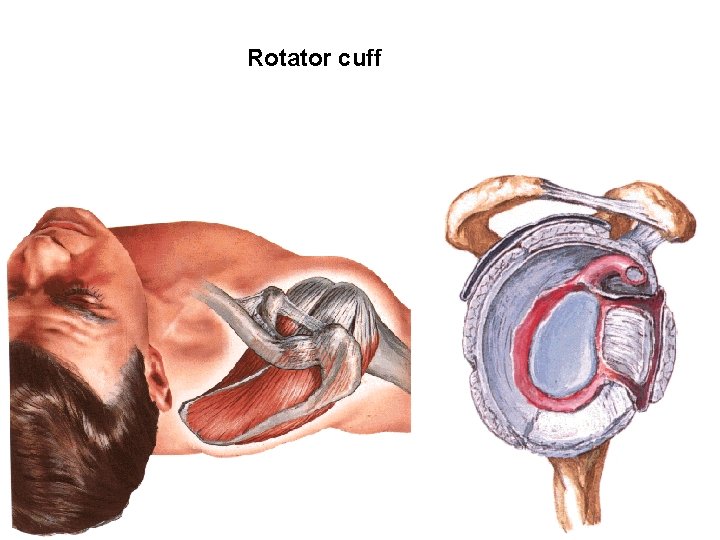 Rotator cuff 