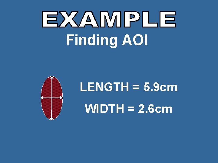 Finding AOI LENGTH = 5. 9 cm WIDTH = 2. 6 cm 