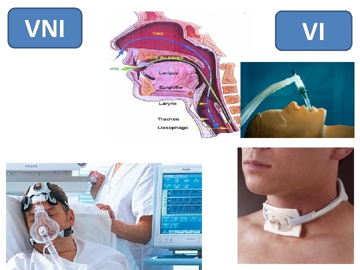 VNI VI 