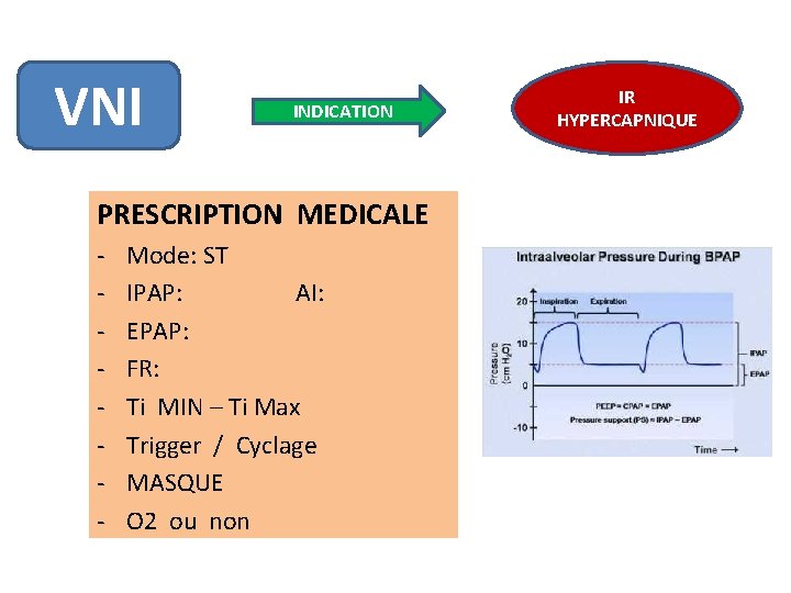 VNI INDICATION PRESCRIPTION MEDICALE - Mode: ST IPAP: AI: EPAP: FR: Ti MIN –