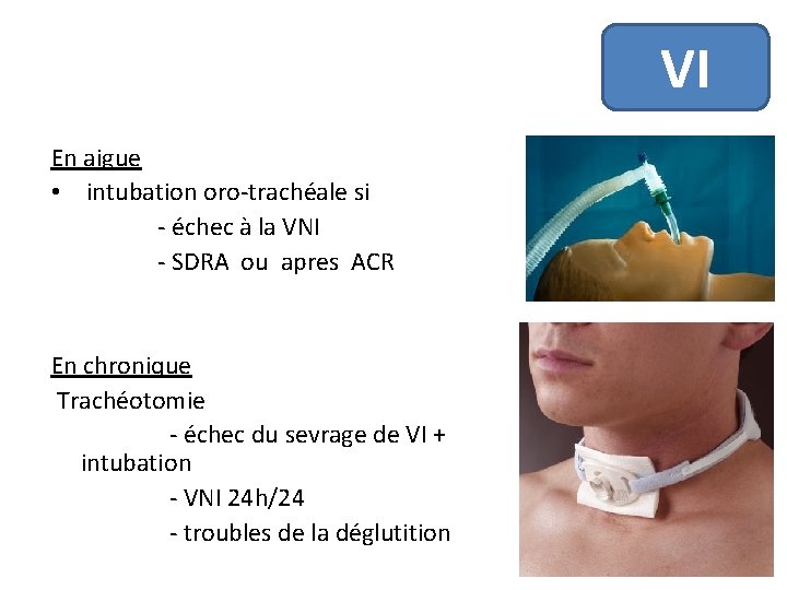 VI En aigue • intubation oro-trachéale si - échec à la VNI - SDRA