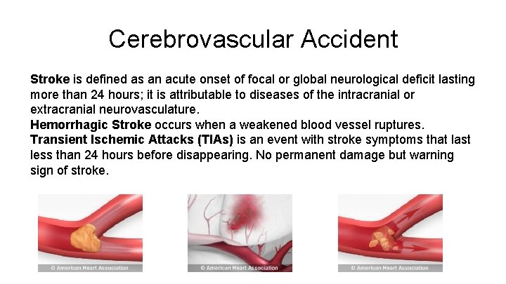 Cerebrovascular Accident Stroke is defined as an acute onset of focal or global neurological