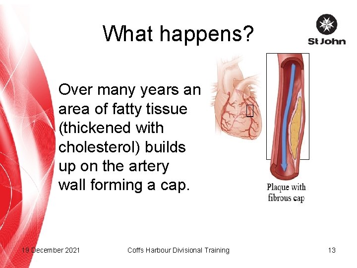 What happens? Over many years an area of fatty tissue (thickened with cholesterol) builds