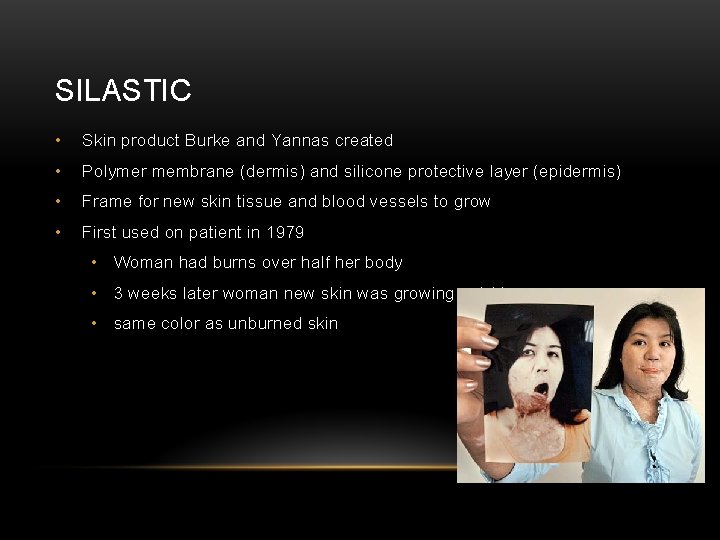 SILASTIC • Skin product Burke and Yannas created • Polymer membrane (dermis) and silicone