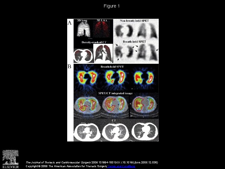 Figure 1 The Journal of Thoracic and Cardiovascular Surgery 2006 131994 -1001 DOI: (10.