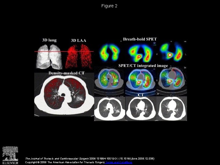 Figure 2 The Journal of Thoracic and Cardiovascular Surgery 2006 131994 -1001 DOI: (10.