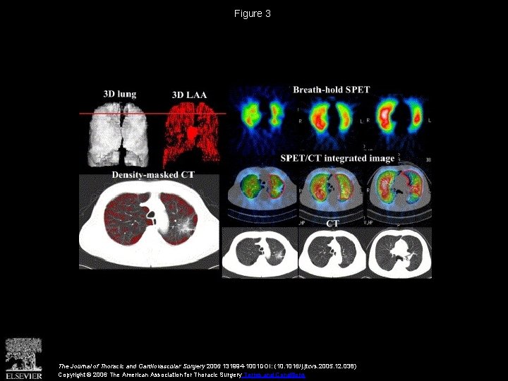 Figure 3 The Journal of Thoracic and Cardiovascular Surgery 2006 131994 -1001 DOI: (10.