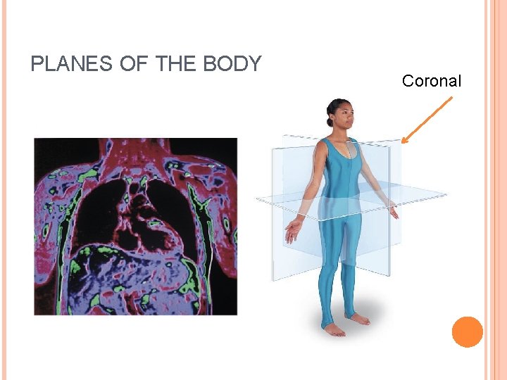 PLANES OF THE BODY Coronal 