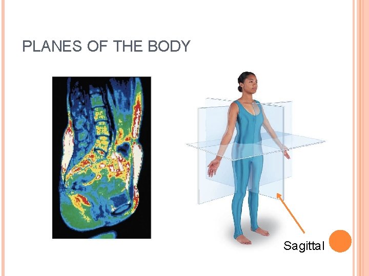 PLANES OF THE BODY Sagittal 