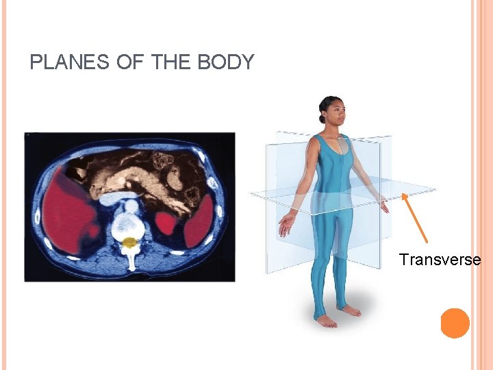 PLANES OF THE BODY Transverse 