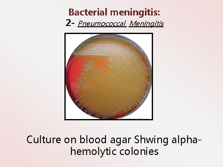 Bacterial meningitis: 2 - Pneumococcal Meningitis Culture on blood agar Shwing alphahemolytic colonies 