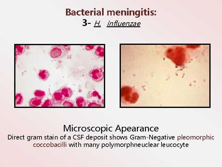 Bacterial meningitis: 3 - H. influenzae Microscopic Apearance Direct gram stain of a CSF