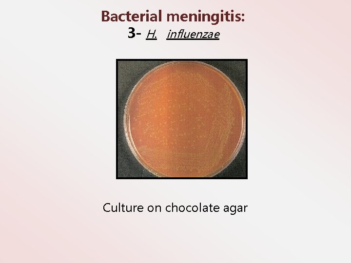 Bacterial meningitis: 3 - H. influenzae Culture on chocolate agar 